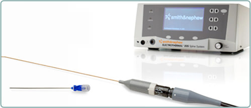 Tratamento eletro-térmico dos discos intervertebrais: catéter flexível introduzido no disco intervertebral através de uma agulha e conectado a aparelho com auto-regulagem de temperatura e parametrizado